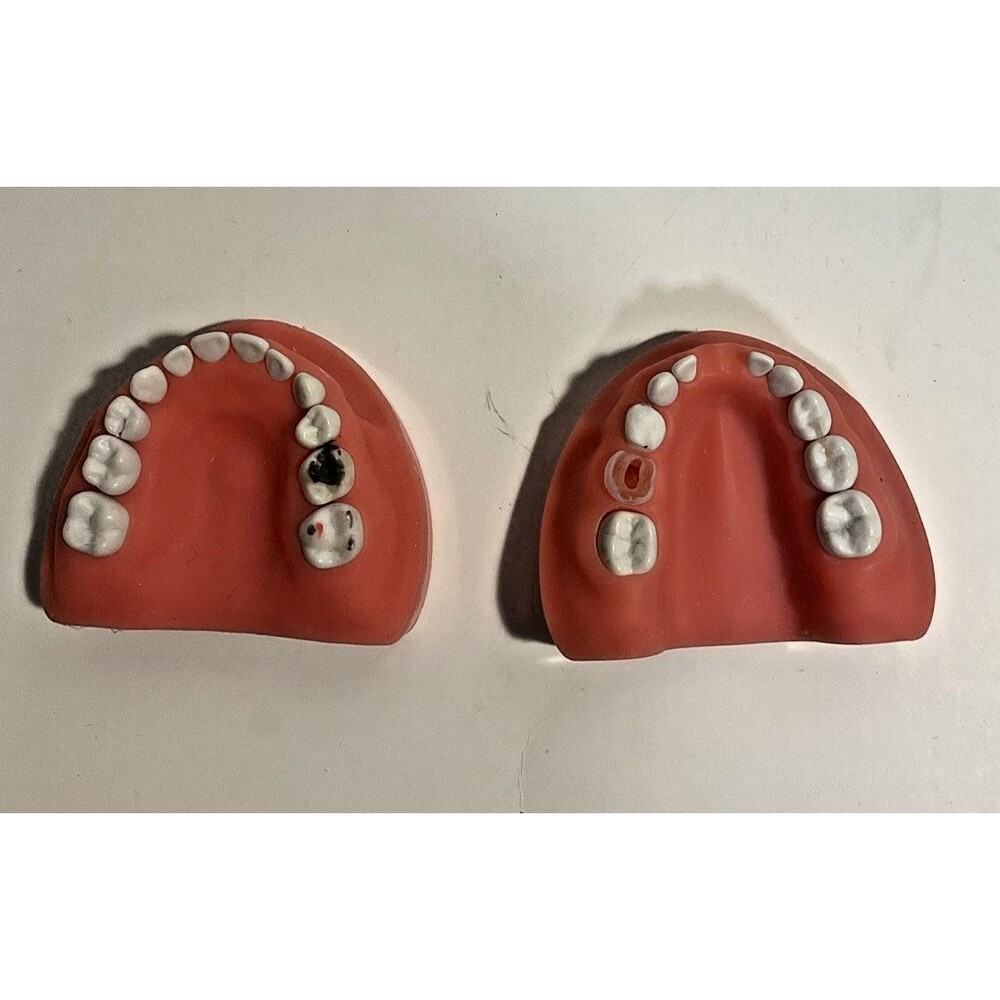 Pediatric Dental Typodont Model